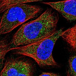 ZNF720 Antibody, Novus Biologicals 25 &mu;L; Unlabeled:Antibodies, Polyclonal